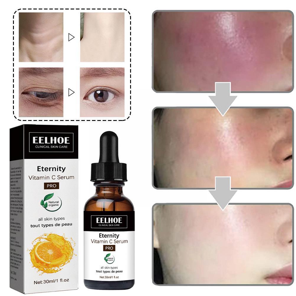 Eelhoe Dark Spot Corrector Gezichtsserum Beauty